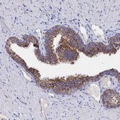 Anti-MMAB antibody produced in rabbit Prestige Antibodies&#174; Powered by Atlas Antibodies, affinity isolated antibody, buffered aqueous glycerol solution