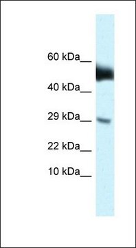 Anti-AMHR2 antibody produced in rabbit affinity isolated antibody