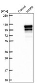 Anti-MMP9 antibody produced in rabbit Prestige Antibodies&#174; Powered by Atlas Antibodies, affinity isolated antibody, buffered aqueous glycerol solution