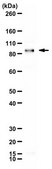 Anti-Nerve Growth Factor Receptor Antibody, p75 serum, Chemicon&#174;