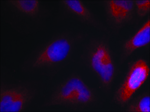 Anti-phospho-MARCKS (pSer162) antibody produced in rabbit affinity isolated antibody