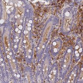 Anti-SLC11A1 antibody produced in rabbit Prestige Antibodies&#174; Powered by Atlas Antibodies, affinity isolated antibody, buffered aqueous glycerol solution