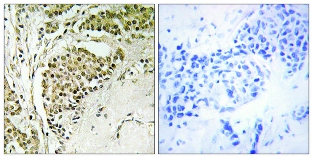 Anti-NOM1, C-Terminal antibody produced in rabbit affinity isolated antibody
