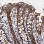 Anti-PRKCI antibody produced in rabbit affinity isolated antibody, buffered aqueous glycerol solution