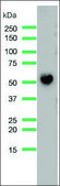 Anti-CD14 antibody, Rabbit monoclonal clone SP192, recombinant, expressed in proprietary host, affinity isolated antibody