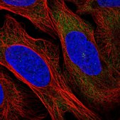 Anti-RRM1 antibody produced in rabbit Prestige Antibodies&#174; Powered by Atlas Antibodies, affinity isolated antibody, buffered aqueous glycerol solution