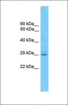 Anti-TMEM139, (N-terminal) antibody produced in rabbit affinity isolated antibody