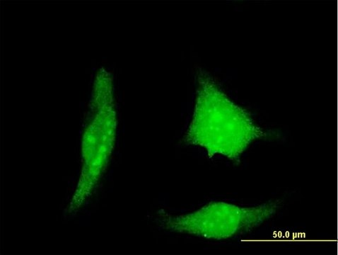 Monoclonal Anti-DSCR1 antibody produced in mouse clone 1B1, purified immunoglobulin, buffered aqueous solution