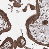 Anti-LTV1 antibody produced in rabbit Prestige Antibodies&#174; Powered by Atlas Antibodies, affinity isolated antibody, buffered aqueous glycerol solution, ab2