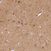 Anti-FSCN1 antibody produced in rabbit Prestige Antibodies&#174; Powered by Atlas Antibodies, affinity isolated antibody