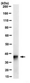 Anti-Gremlin-1 Antibody, clone 2H1.1 clone 2H1.1, from mouse