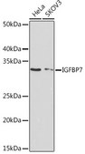 Anti-IGFBP7 Antibody, clone 8M10Q9, Rabbit Monoclonal