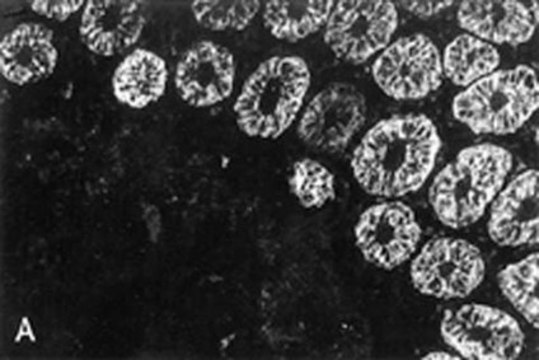 Anti-Cytokeratin 18 Antibody, clone RCK106 clone RCK106, Chemicon&#174;, from mouse