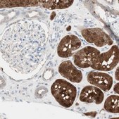 Anti-KHK antibody produced in rabbit Prestige Antibodies&#174; Powered by Atlas Antibodies, affinity isolated antibody, buffered aqueous glycerol solution