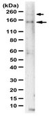Anti-L1CAM Antibody from rabbit, purified by affinity chromatography