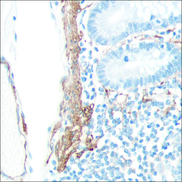 Anti-SMA antibody, Rabbit monoclonal clone SP171, recombinant, expressed in proprietary host, affinity isolated antibody