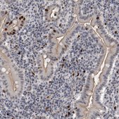 Anti-KIF18B antibody produced in rabbit Prestige Antibodies&#174; Powered by Atlas Antibodies, affinity isolated antibody, buffered aqueous glycerol solution