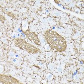 Anti- APP antibody produced in rabbit