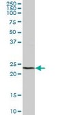 Anti-DTYMK antibody produced in mouse purified immunoglobulin, buffered aqueous solution