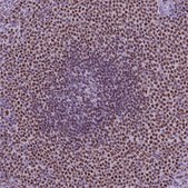 Anti-SP140 antibody produced in rabbit Prestige Antibodies&#174; Powered by Atlas Antibodies, affinity isolated antibody, buffered aqueous glycerol solution