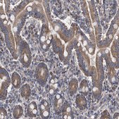 Anti-BCL2L12 antibody produced in rabbit Prestige Antibodies&#174; Powered by Atlas Antibodies, affinity isolated antibody, buffered aqueous glycerol solution