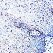 Anti-MMP3 antibody produced in rabbit
