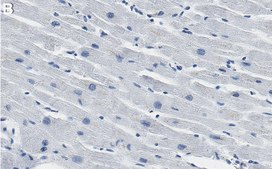 Anti-AGK Antibody, clone 1F21 ZooMAb&#174; Rabbit Monoclonal recombinant, expressed in HEK 293 cells