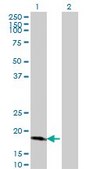 Monoclonal Anti-CDKN2D antibody produced in mouse clone 2E10, purified immunoglobulin, buffered aqueous solution