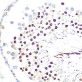 Anti-HP1 alpha/CBX5 antibody produced in rabbit
