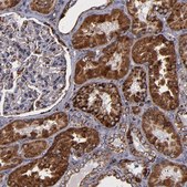 Anti-SOD2 antibody produced in rabbit Prestige Antibodies&#174; Powered by Atlas Antibodies, affinity isolated antibody, buffered aqueous glycerol solution