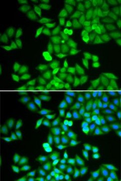 Anti- RhoGDI antibody produced in rabbit