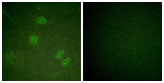 Anti-ELK3 antibody produced in rabbit affinity isolated antibody