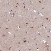 Anti-TMEM132A antibody produced in rabbit Prestige Antibodies&#174; Powered by Atlas Antibodies, affinity isolated antibody, buffered aqueous glycerol solution