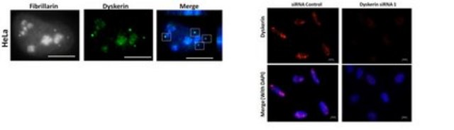 Anti-Dyskerin (Rabbit) from rabbit, purified by affinity chromatography