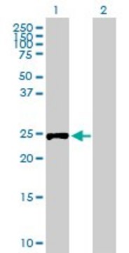 Anti-RPIA antibody produced in mouse purified immunoglobulin, buffered aqueous solution