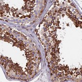 Anti-YBX1 antibody produced in rabbit Prestige Antibodies&#174; Powered by Atlas Antibodies, affinity isolated antibody, buffered aqueous glycerol solution