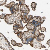 Anti-ADAM17 antibody produced in rabbit Prestige Antibodies&#174; Powered by Atlas Antibodies, affinity isolated antibody, buffered aqueous glycerol solution