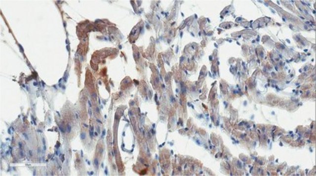 Anti-Lipoprotein Lipase/LPL Antibody, clone 4-1a clone 4-1a, from mouse