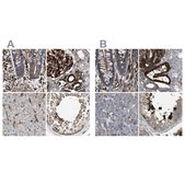 Anti-HIP1 antibody produced in rabbit Prestige Antibodies&#174; Powered by Atlas Antibodies, affinity isolated antibody, buffered aqueous glycerol solution