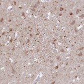 Anti-FAM69C antibody produced in rabbit Prestige Antibodies&#174; Powered by Atlas Antibodies, affinity isolated antibody, buffered aqueous glycerol solution