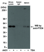Anti-Acetylated-Lysine antibody, Rabbit monoclonal recombinant, expressed in HEK 293 cells, clone RM101, purified immunoglobulin