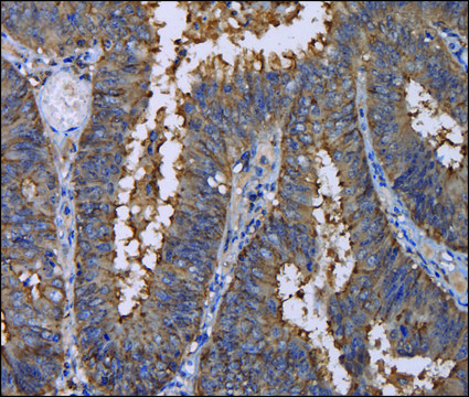 Anti-REG3G antibody produced in rabbit affinity isolated antibody