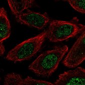 Anti-FAM149B1 antibody produced in rabbit Prestige Antibodies&#174; Powered by Atlas Antibodies, affinity isolated antibody, buffered aqueous glycerol solution