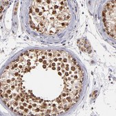 Anti-DIABLO antibody produced in rabbit affinity isolated antibody, buffered aqueous glycerol solution