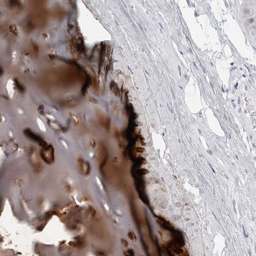 Anti-MATN1 antibody produced in rabbit Prestige Antibodies&#174; Powered by Atlas Antibodies, affinity isolated antibody, buffered aqueous glycerol solution