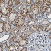 Anti-TMEM25 antibody produced in rabbit Prestige Antibodies&#174; Powered by Atlas Antibodies, affinity isolated antibody, buffered aqueous glycerol solution
