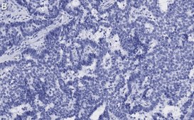 Anti-p-ATM (Ser1981) Antibody, clone 1E19, ZooMAb&#174; Rabbit Monoclonal recombinant, expressed in HEK 293 cells