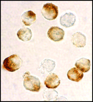 Anti-IKK beta antibody produced in rabbit affinity isolated antibody
