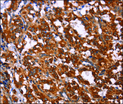 Anti-GPR65 antibody produced in rabbit affinity isolated antibody