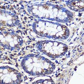 Anti- SND1 antibody produced in rabbit